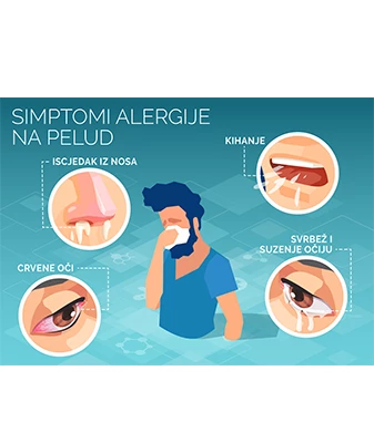 Simptomi alergije na polen Simptomi alergije na polen